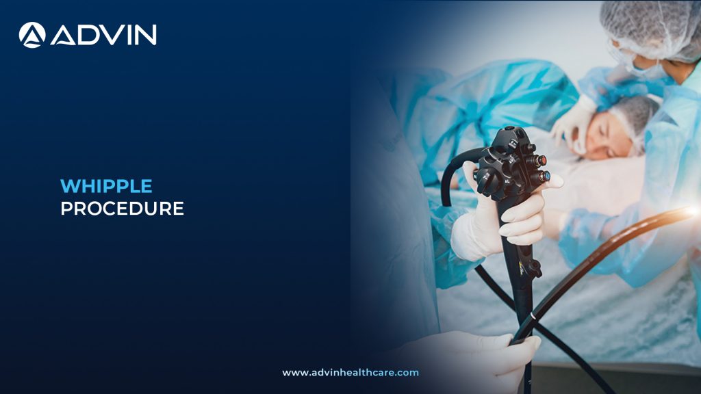 Whipple Procedure – A Complete Guide to Pancreaticoduodenectomy