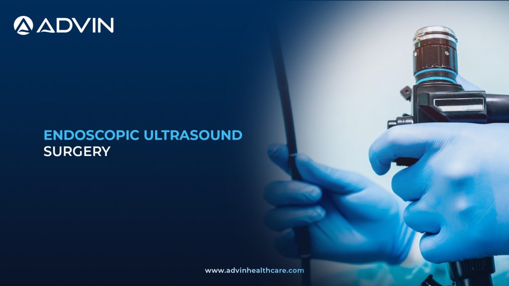 Endoscopic Ultrasound – Modern Technique for GI Evaluation