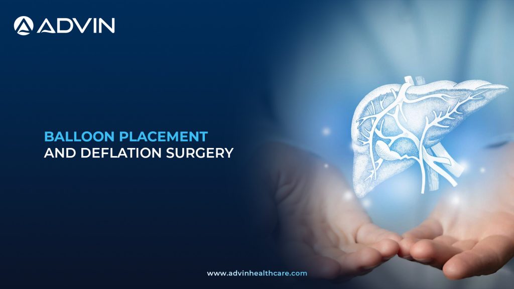 Balloon Placement & Deflation – Safe Gastrology Surgery for Stomach Balloon Therapy