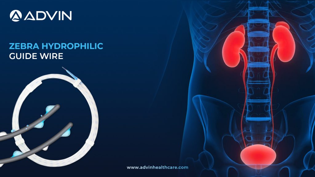 Zebra Hydrophilic Guide Wire – Smooth Navigation for Urological Access