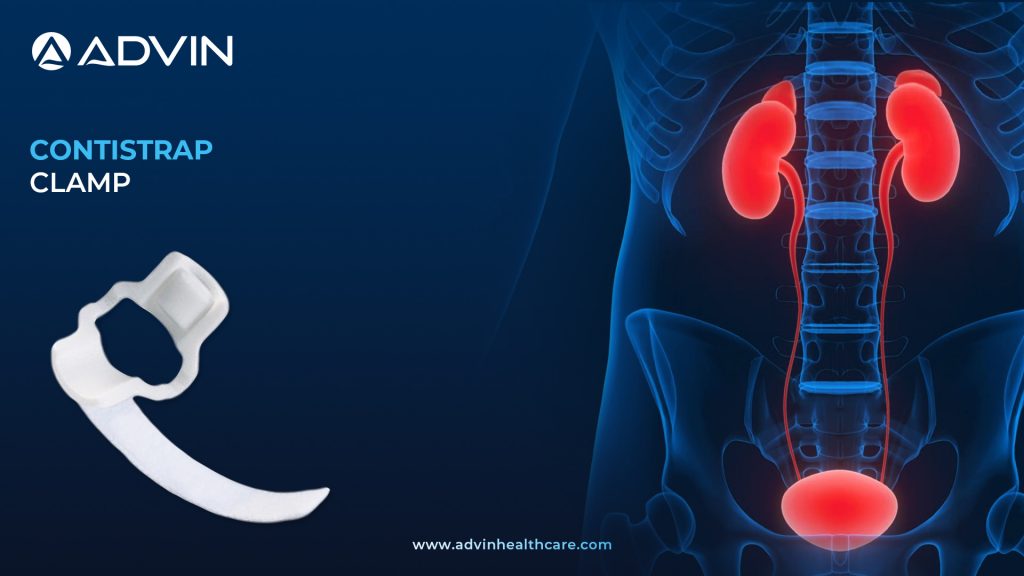 Contistrap Clamp – Non-Surgical Approach to Urinary Leakage Control