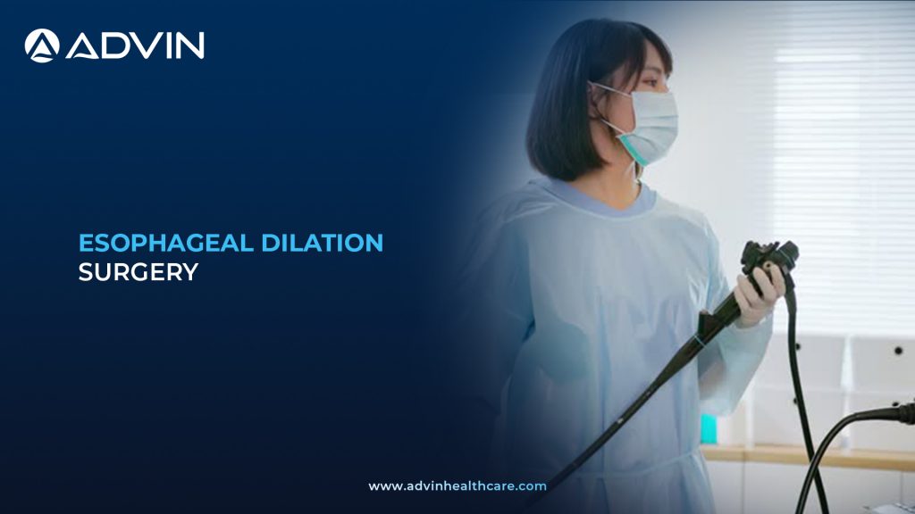 Esophageal Dilation Surgery – A Relief for Swallowing Disorders