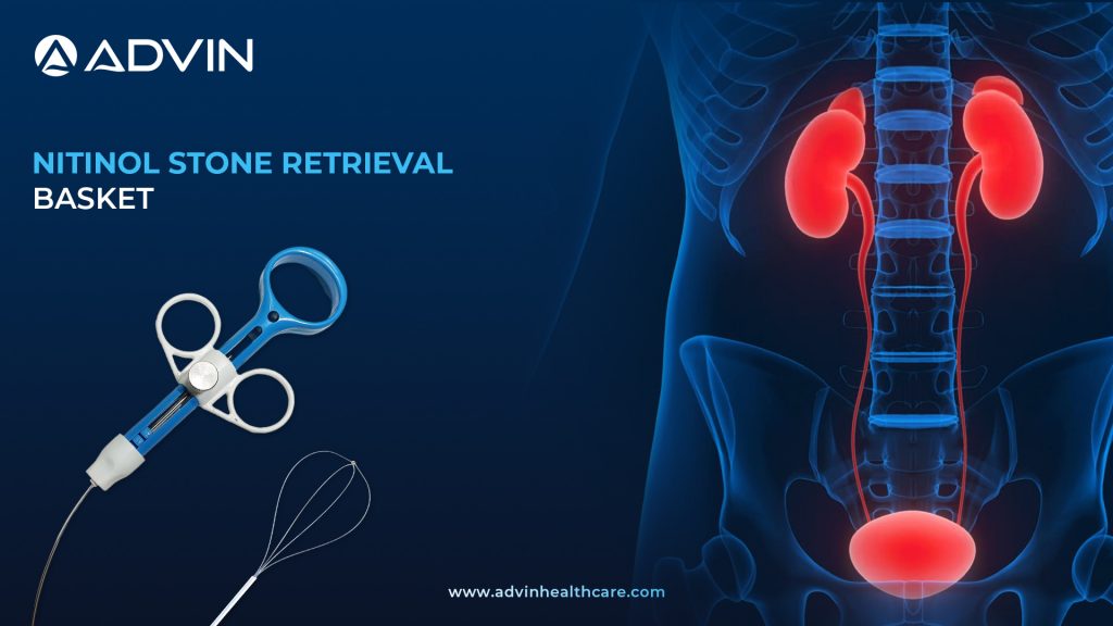 Nitinol Stone Retrieval Basket – Precision Tool for Minimally Invasive Stone Removal