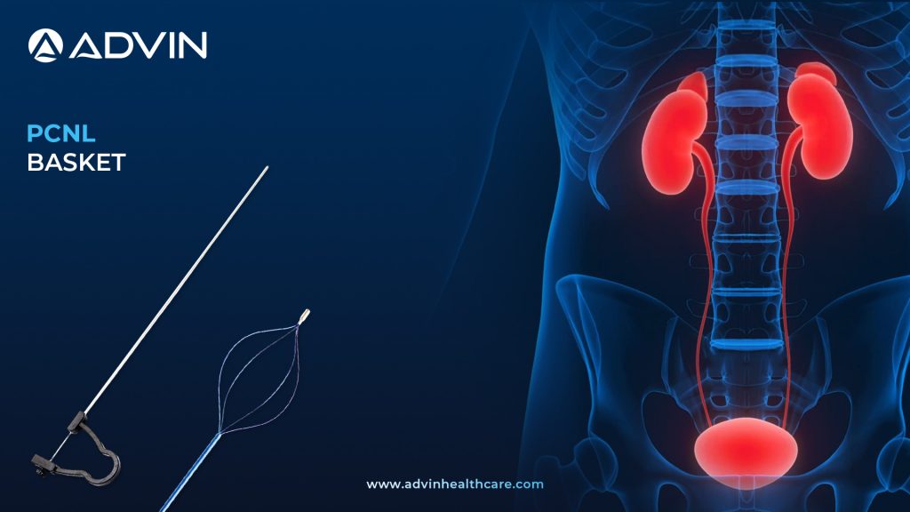 PCNL Basket for Efficient Stone Extraction in Nephrolithotomy Surgery