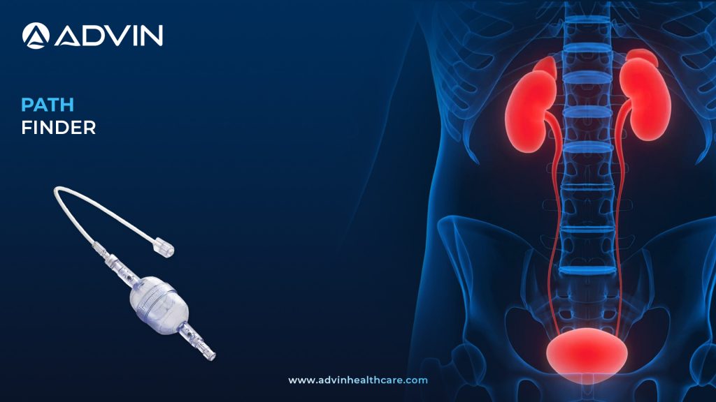 Path Finder – Precision Tool for Safe Ureteral Navigation