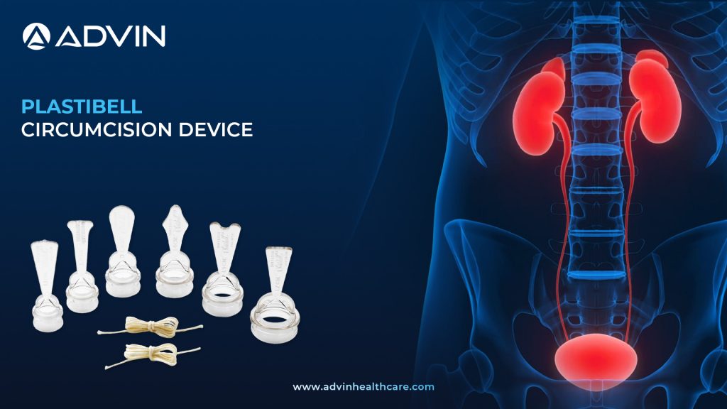 Plastibell Circumcision Device – Safe and Effective Infant Circumcision