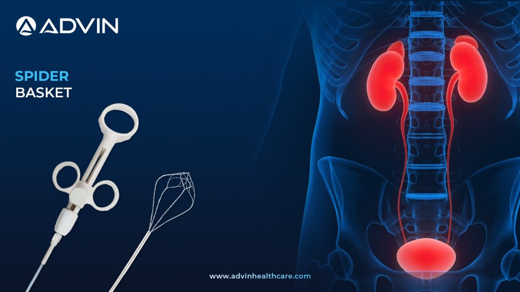 Spider Basket – Advanced Stone Retrieval Tool for Urological Procedures