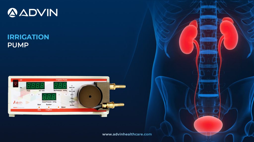 Advin URO Irrigation Pump – Advanced Fluid Management in Urology