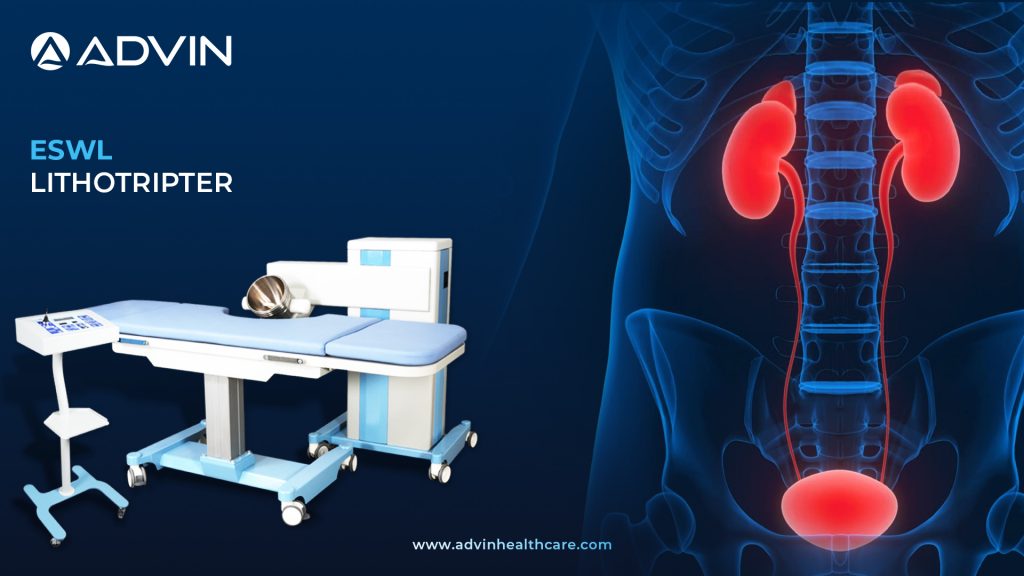 ESWL Lithotripter – Non-Invasive Solution for Kidney Stone Treatment