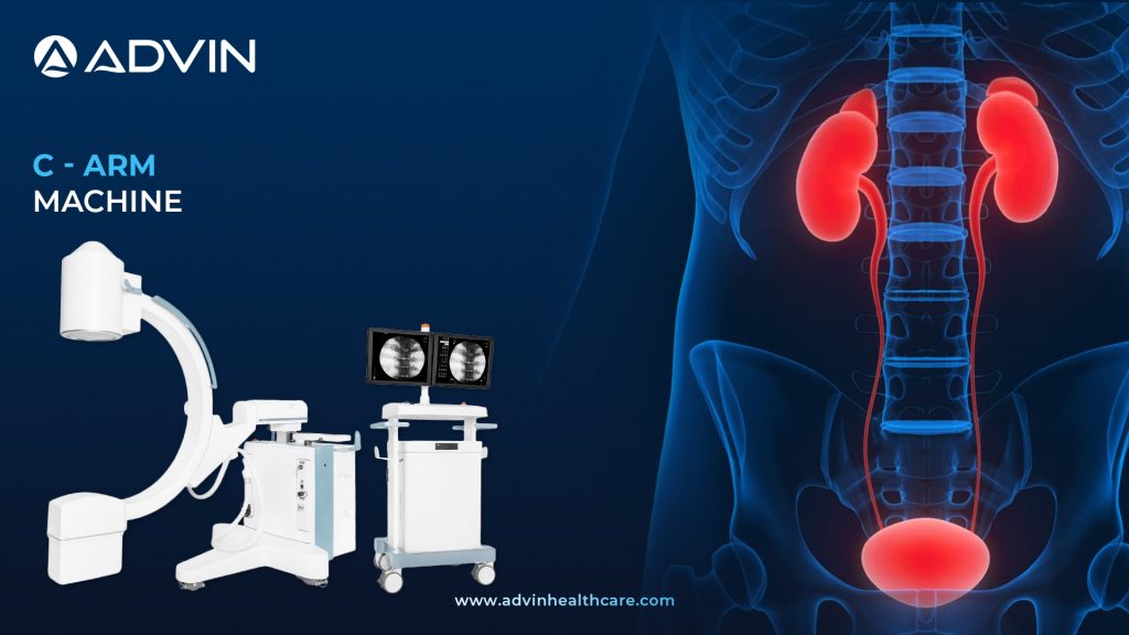 C-Arm Machine – Advanced Imaging for Surgery & Diagnostics