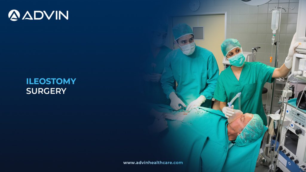 Ileostomy Surgery – Effective Treatment for Severe Gastrointestinal Conditions