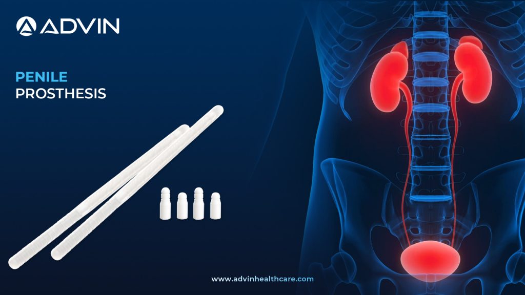 Penile Prosthesis – Advanced Solution for Erectile Dysfunction