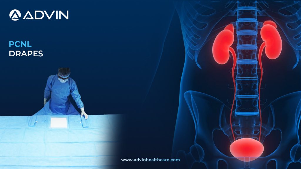 PCNL Drape – Essential Sterile Drape for Percutaneous Nephrolithotomy