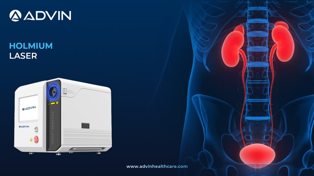 Holmium Laser – Gold Standard Technology in Urology Stone Surgery