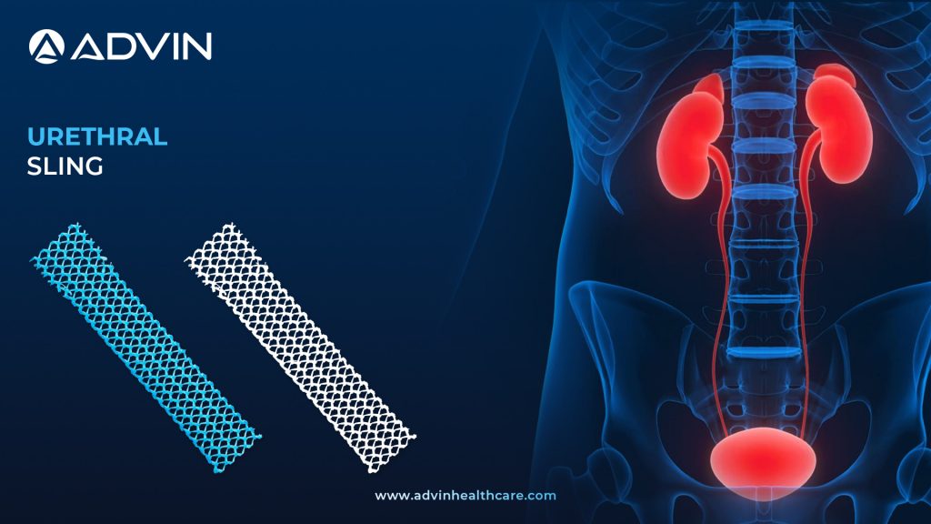 Urethral Sling – Advanced Treatment for Stress Urinary Incontinence