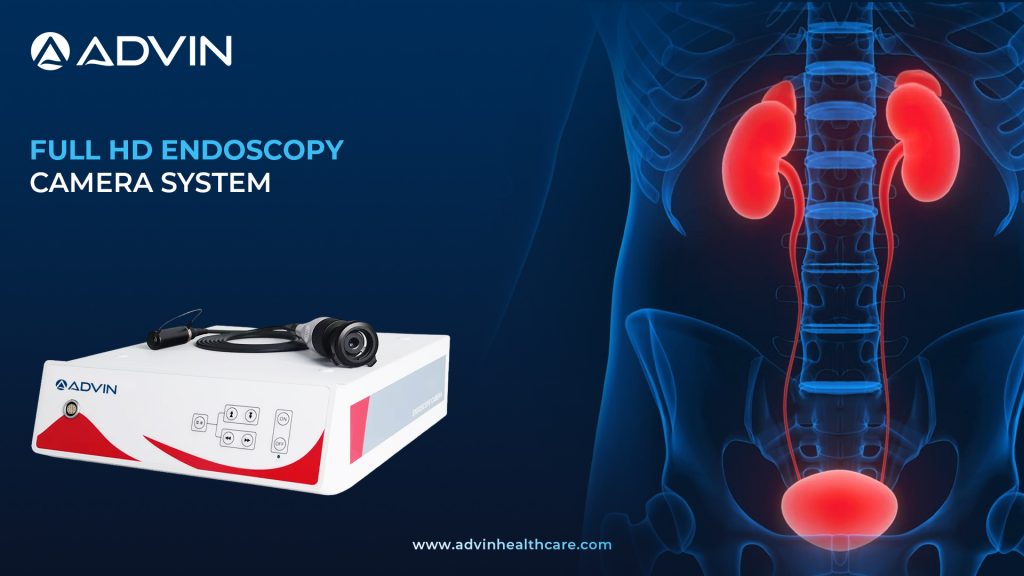 Full HD Endoscopy Camera System – Crystal-Clear Visualization for Precision Surgery