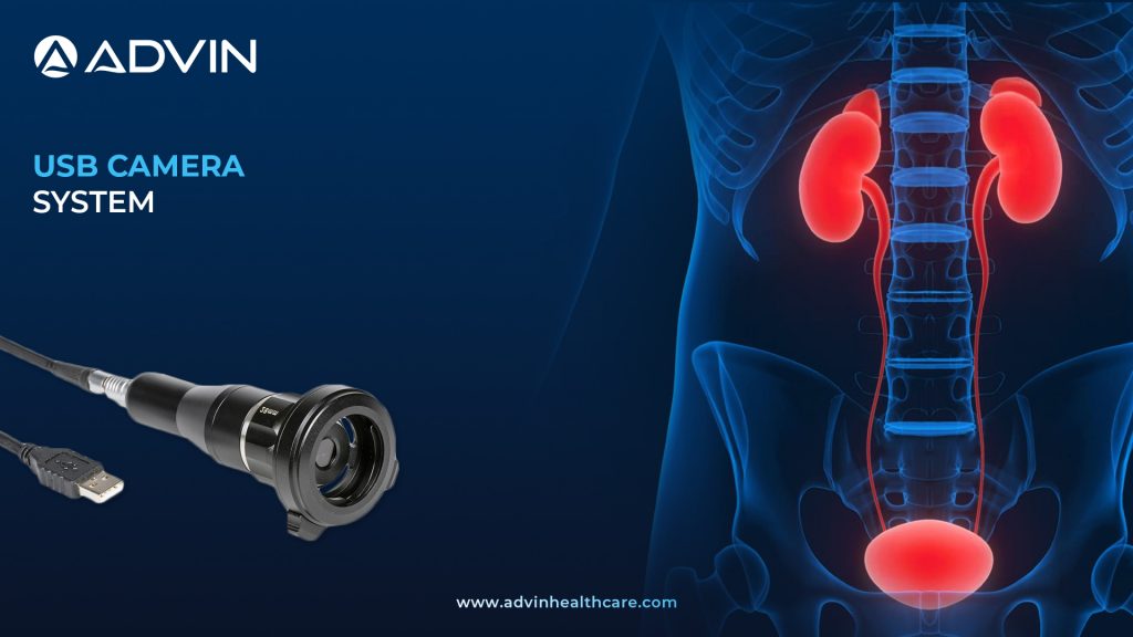 USB Camera System – Compact Solution for Clear Endoscopic Imaging