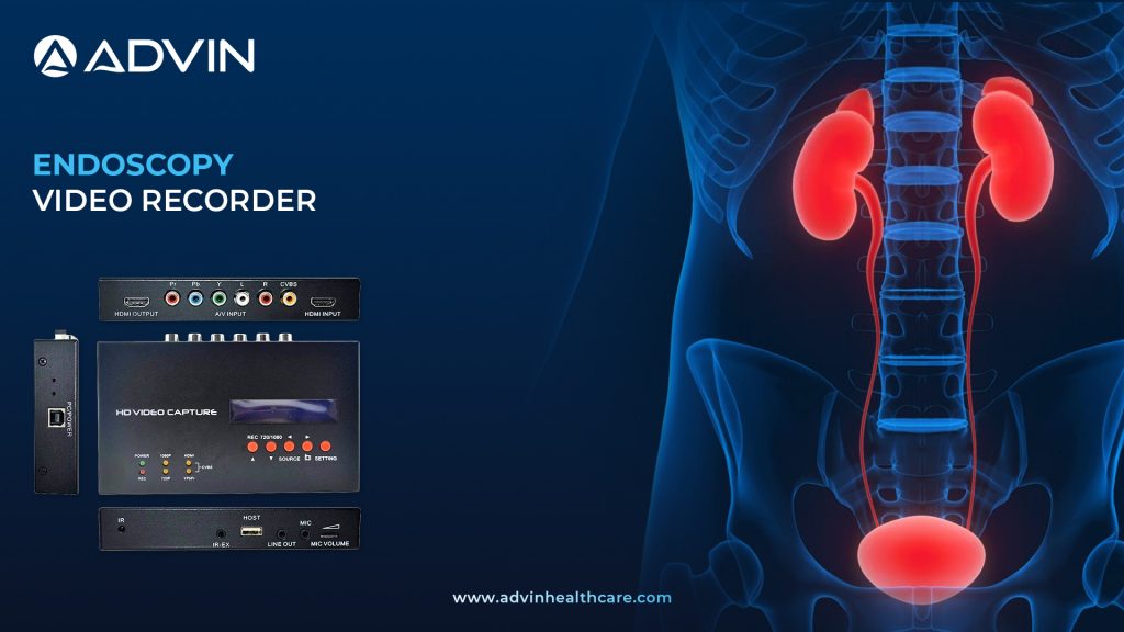Endoscopy Video Recorder – Reliable Recording Solution for Surgical Documentation