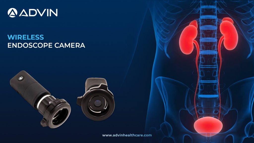 Wireless Endoscope Camera – Portable, Efficient & High-Resolution Imaging