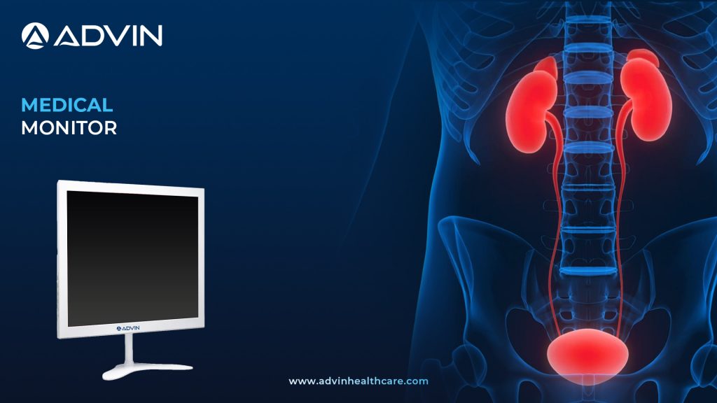 Medical Monitor – High-Resolution Display for Urology, Laparoscopy & More
