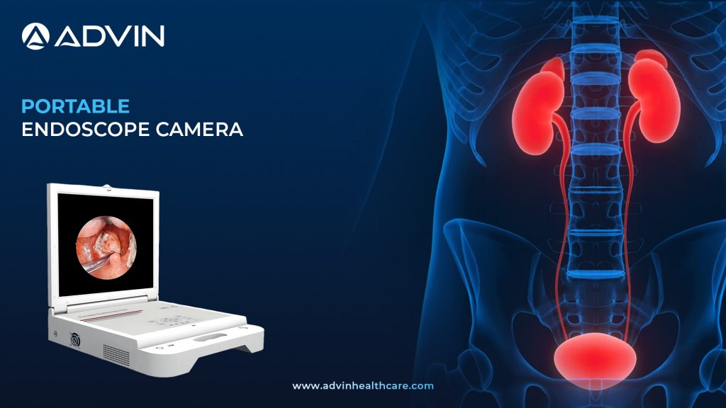 Portable Endoscope Camera – Compact Imaging Solution for Modern Surgery