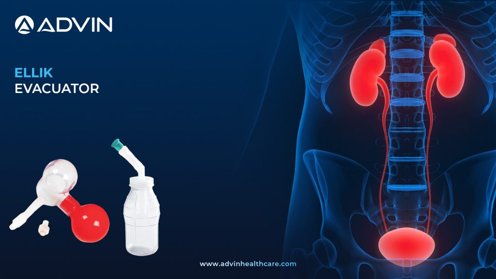 Ellik Evacuator – Essential Device for Efficient Bladder Evacuation During TURP