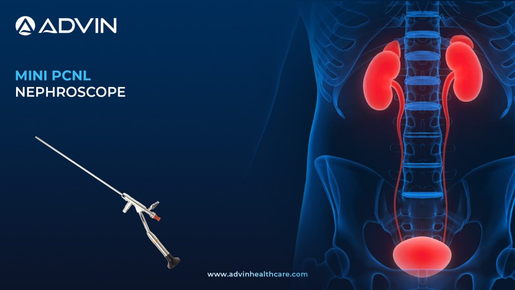 Mini PCNL Nephroscope – Advanced Solution for Minimally Invasive Kidney Stone Surgery