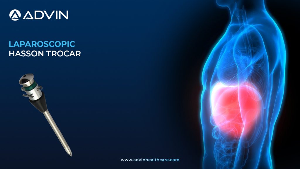 Hasson Trocar – Secure and Safe Entry Technique for Laparoscopic Surgery