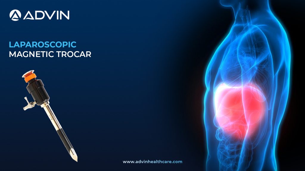 Magnetic Trocar – Innovative Access Solution for Laparoscopic Surgery