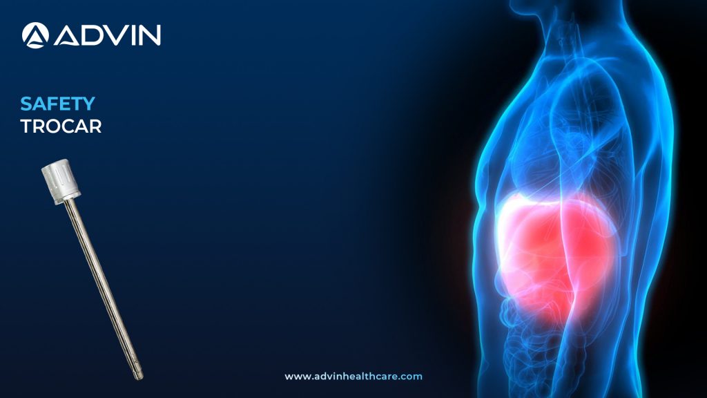 Safety Trocar – Advanced Protection for Laparoscopic Entry Procedures