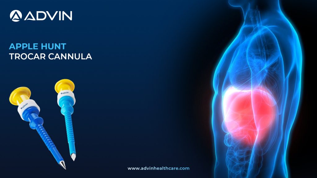 Apple Hunt Trocar Cannula – Reliable Access System for Laparoscopic Surgery