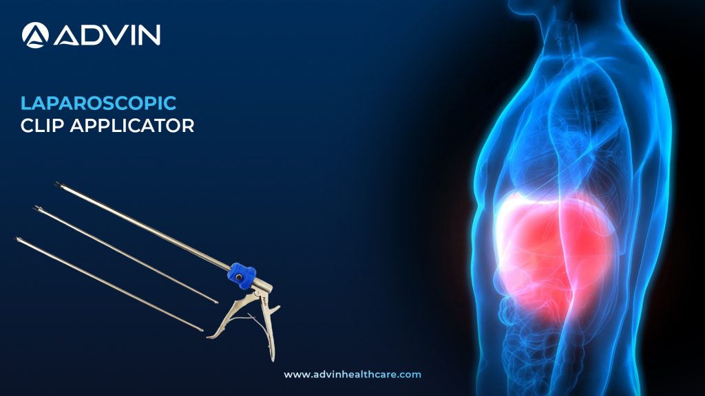 Laparoscopic Clip Applicator – Optimized for Accurate Clip Placement in Laparoscopy