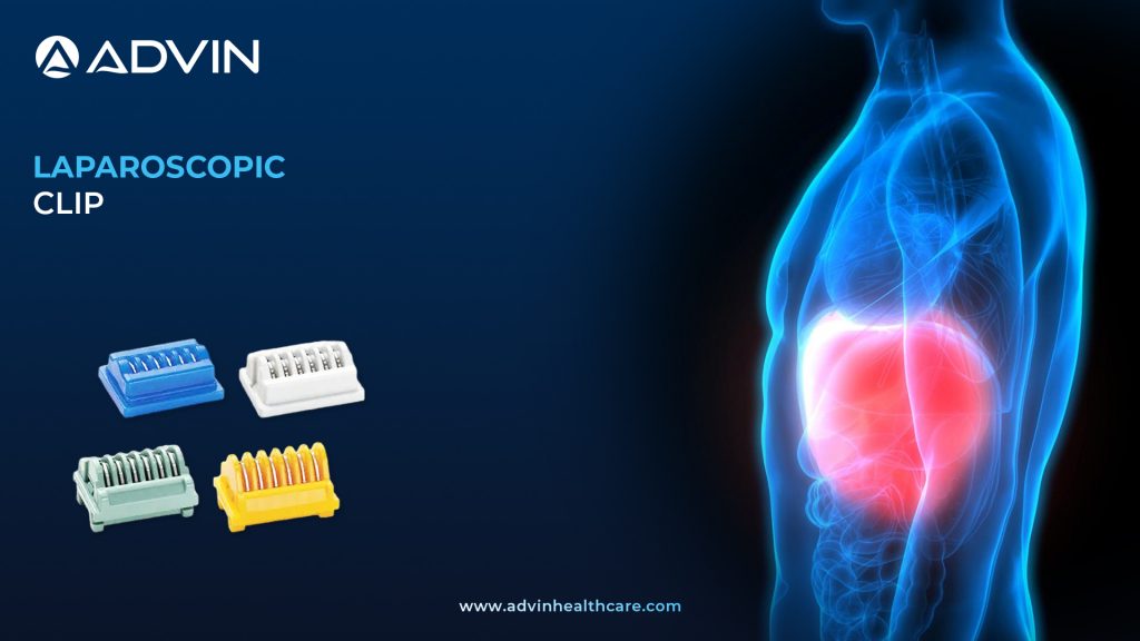 Laparoscopic Clips – High-Quality Surgical Clips for Minimally Invasive Procedures