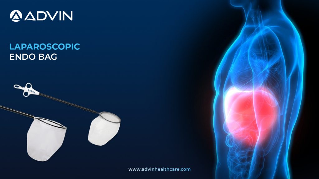 Laparoscopic Endo Bag – Safe and Sterile Extraction Solution for Laparoscopic Procedures