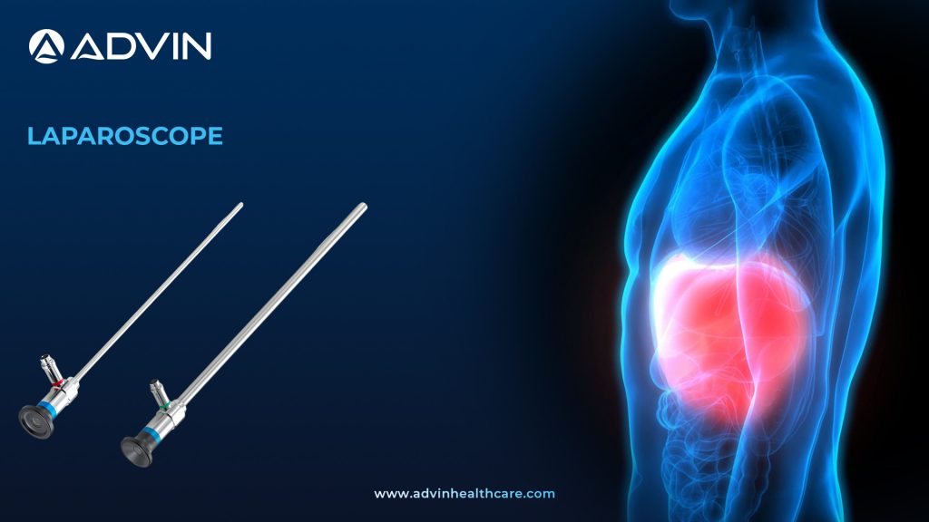Laparoscope – Essential Visualization Tool for Minimally Invasive Surgery