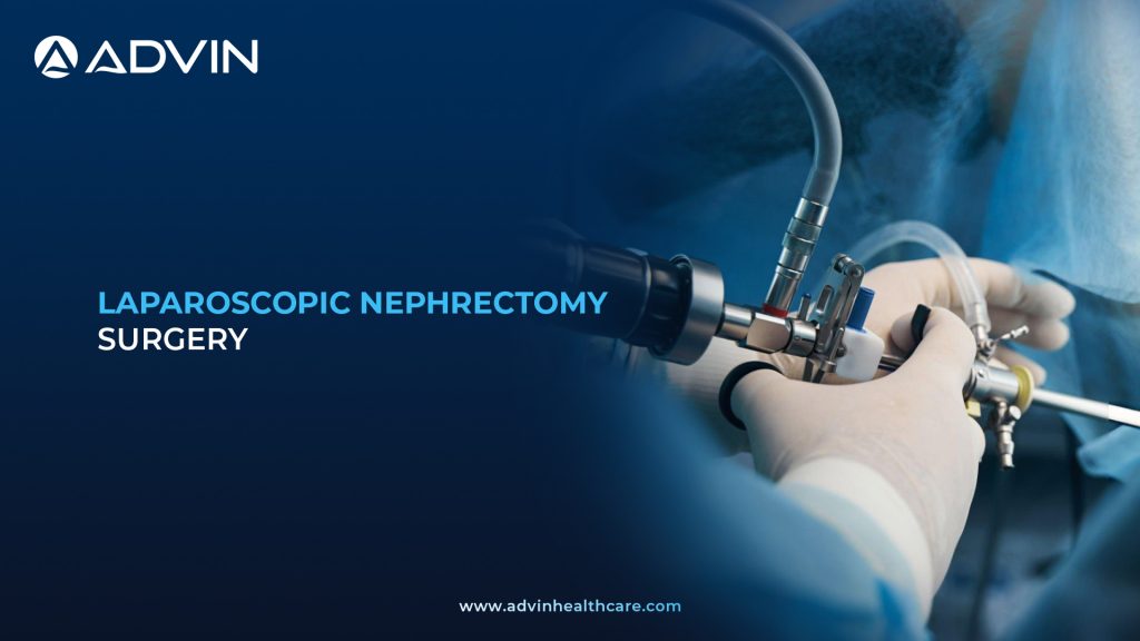 Laparoscopic Nephrectomy – Advanced Laparoscopic Technique Ensuring Accurate Renal Excision.