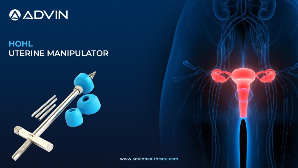 HOHL Uterine Manipulator – High-Performance Manipulator Supporting Safe and Efficient Procedures.