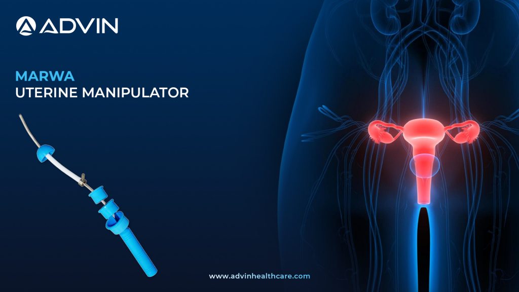 Marwa Uterine Manipulator – Advanced Gynecologic Instrument Enhancing Operative Access and Visibility.