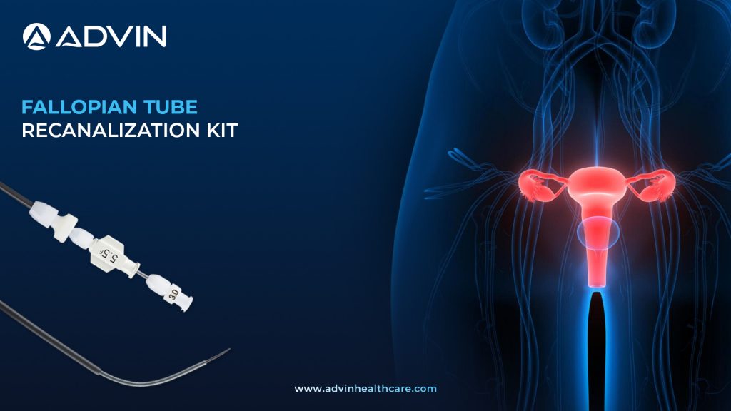 Fallopian Tube Recanalization Kit – Reliable, Minimally Invasive Solution for Tubal Recanalization.