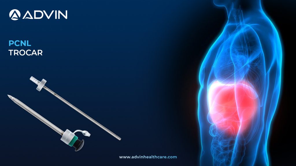 PCNL Trocar – Essential Access Tool for Safe and Precise Renal Puncture