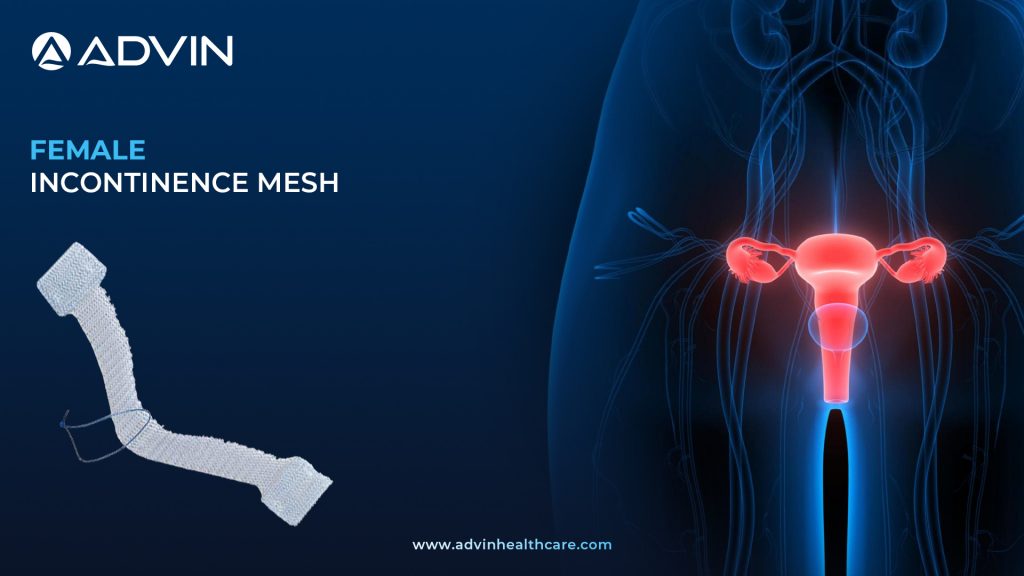 Female Incontinence Mesh – Advanced Stabilization Solution for Long-Lasting Incontinence Management.