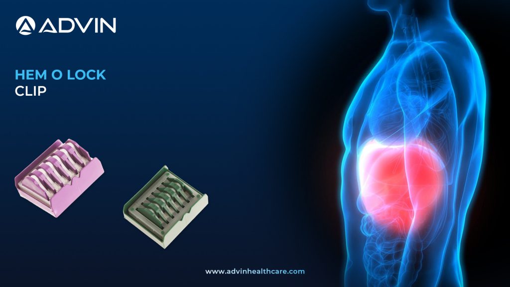 Hem O Lock Clip – Trusted Surgical Clip for Laparoscopic and Open Procedures