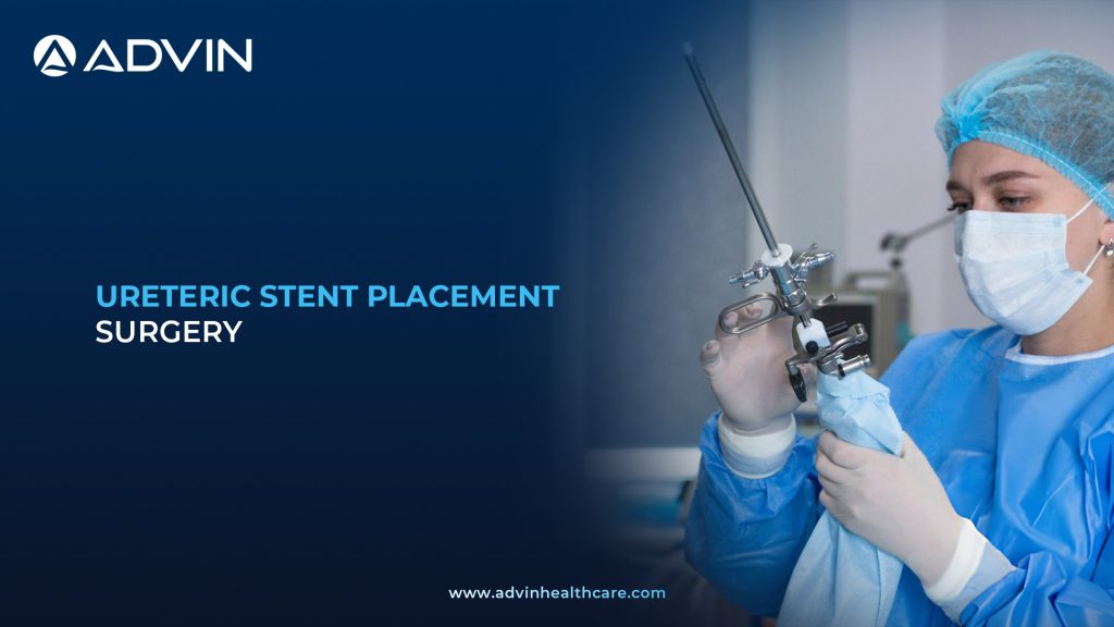 Ureteric Stent Placement Surgery – Precision Endourologic Procedure for Safe Urinary Drainage.