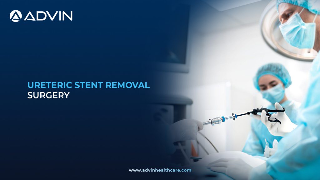 Ureteric Stent Removal Surgery – Safe and Controlled Endoscopic Procedure for Stent Extraction.