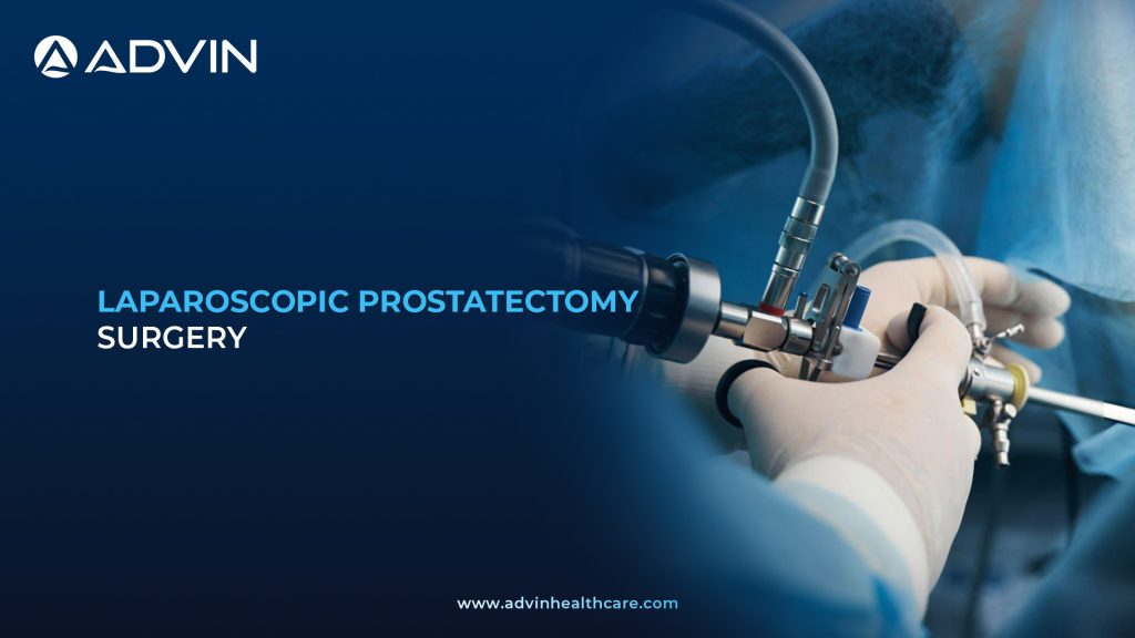Laparoscopic Prostatectomy Surgery – Minimally Invasive Surgery for Prostate Disease