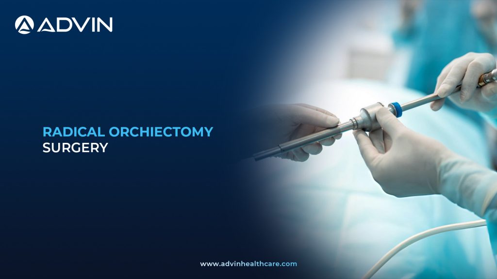 Radical Orchiectomy Surgery – Advanced Surgical Approach for Complete Testis and Cord Removal