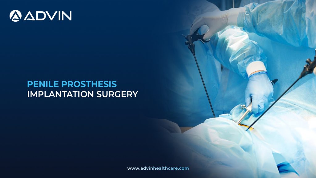 Penile Prosthesis Implantation Surgery – Advanced Urologic Procedure for Erectile Dysfunction Treatment.