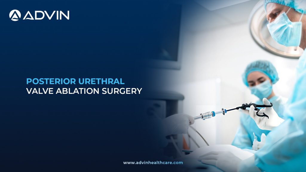 Posterior Urethral Valve Ablation Surgery – Endoscopic Surgical Technique for Relieving Bladder Outlet Obstruction