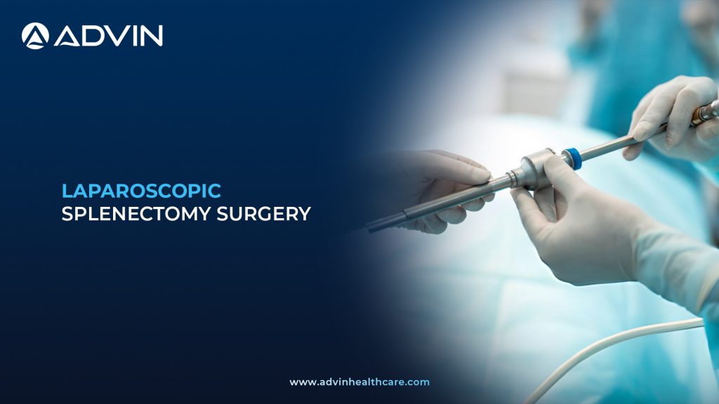 Laparoscopic Salpingectomy Surgery – Advanced Endoscopic Technique for Treating Tubal Pathologies