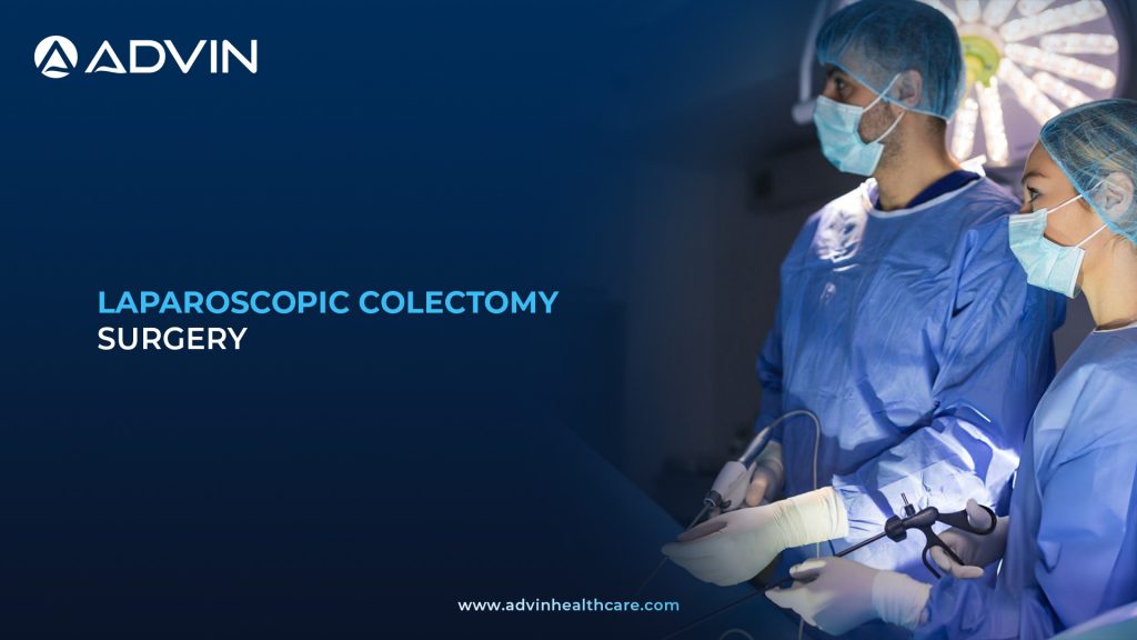 Laparoscopic Colectomy Surgery – Advanced Endoscopic Technique for Colorectal Disease Management
